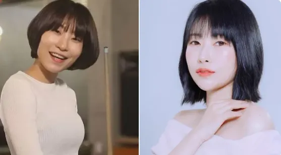 Le comédien Lee Se Young a livré son « statut visuel » après une chirurgie plastique