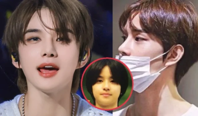 NCT Jungwoo acusado de someterse a una operación de nariz después de que resurgieran las fotos previas al debut de Idol