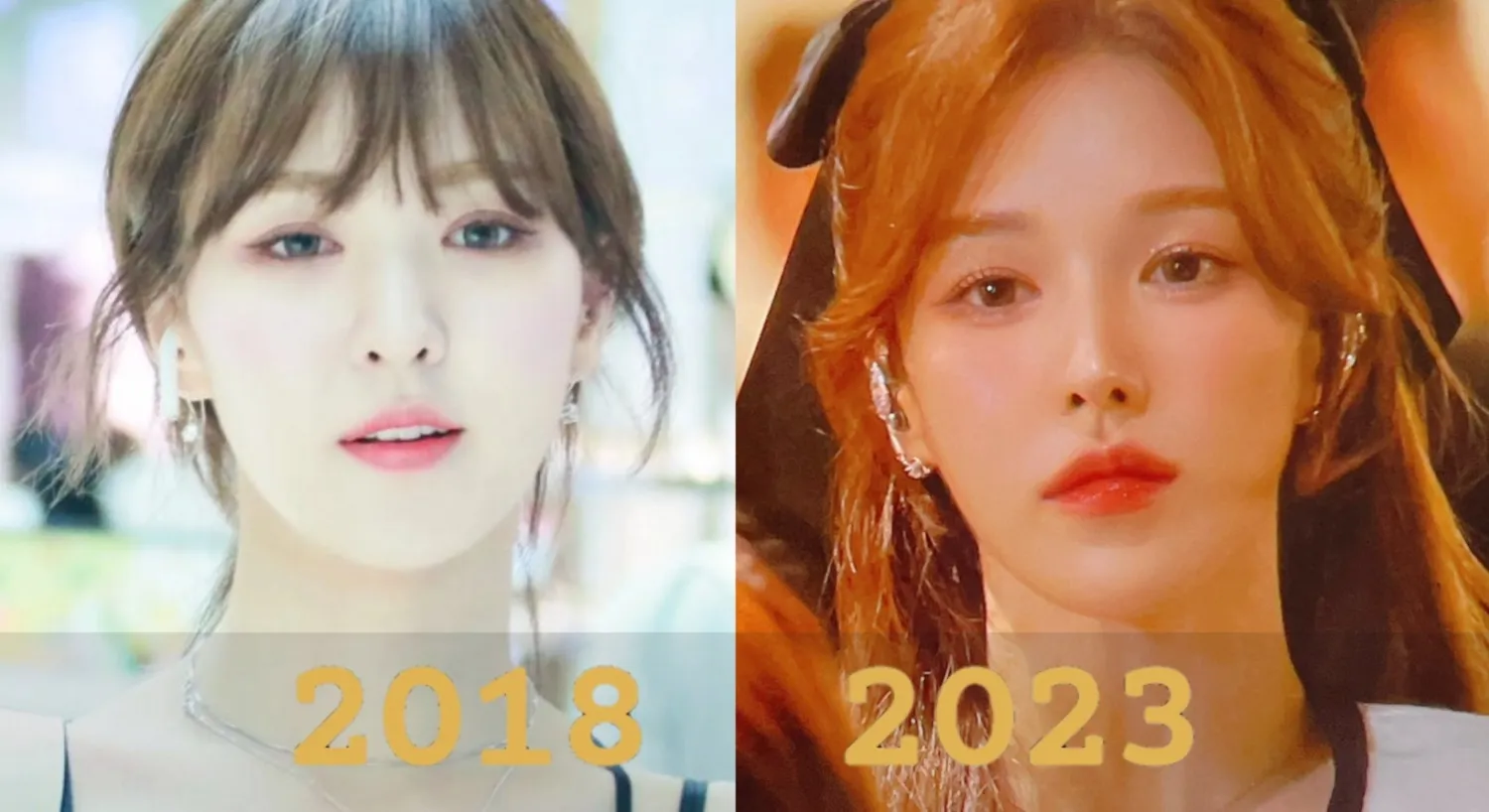 Red Velvet Wendy atrai reações mistas para 'mudança' em Visual - Cirurgia Plástica ou Novo Penteado?