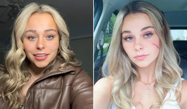 La célèbre « scar girl » de TikTok répond aux réactions négatives après que la blessure ait soudainement disparu du visage