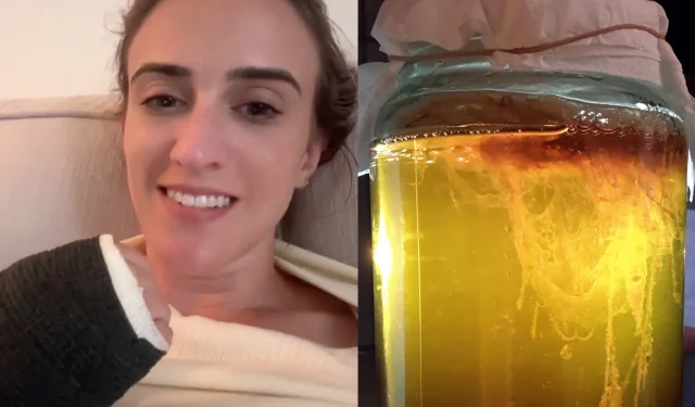 Une femme prévient que les vieilles bouteilles de Kombucha pourraient exploser soudainement