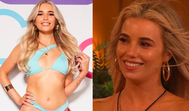 Lana, da Love Island, explica por que ela fez uma plástica nos seios em uma mensagem honesta aos fãs