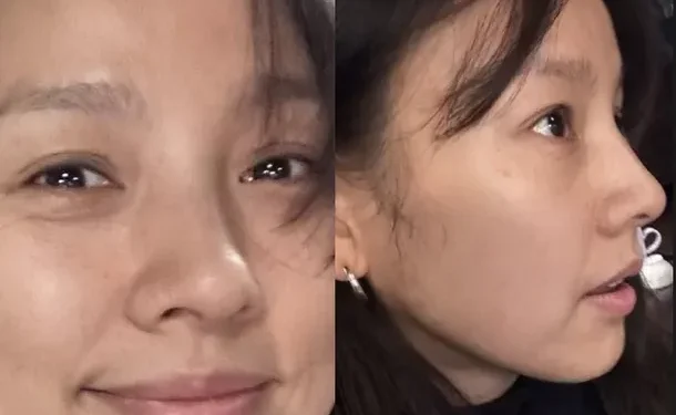 Lee Hyori, de 45 años, comparte selfies con la cara descubierta y mostrando arrugas y pecas