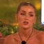 Les fans de Love Island sont confus alors que la star affirme qu’elle n’a jamais eu recours à la chirurgie plastique