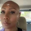 Towanda Braxton racconta il suo percorso contro la caduta dei capelli: “Non me ne vergogno più” nell’episodio 7 di The Braxtons