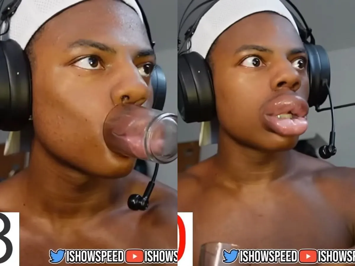 Speed's Kylie Lip Challenge gone wrong (Image via YouTube/@Live Speedy)