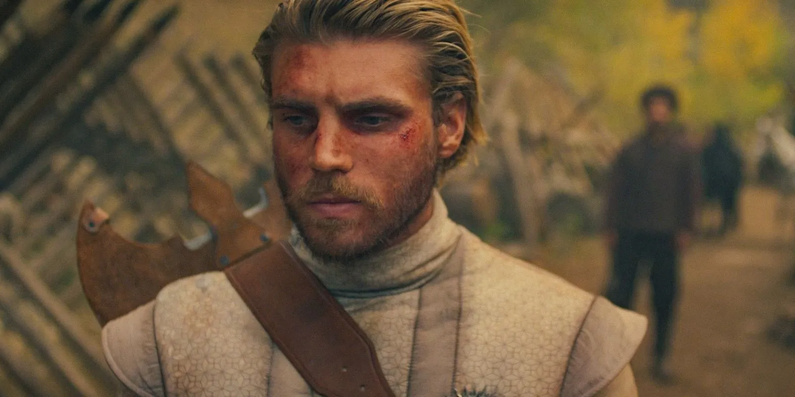 Lord Luc (Michael Lindall) with injuries on his face in The Wheel of Time Season 3 Ep 7