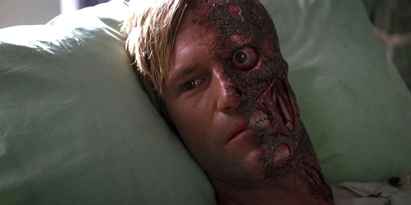 Aaron Eckhart as Two-Face lays in a hospital bed in The Dark Knight